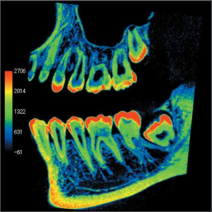 PreXion Eclipse XP77 2D 3D CBCT Pan Ceph 11.3x7.5 FOV مع الكمبيوتر الشخصي، ضمان