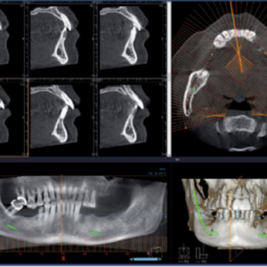 Vatech PaX Duo 2D 3D CBCT Pan FOV 12x8.5 مع الكمبيوتر الشخصي، ضمان