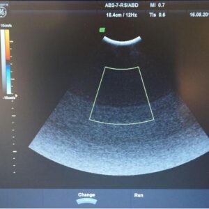 GE Voluson E AB2-7-RS convex probe