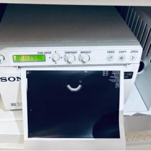 Refurbished GE Voluson E8