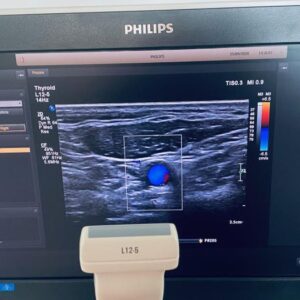 Used PHILIPS Epiq 5