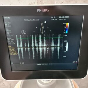 Refurbished PHILIPS Sparq