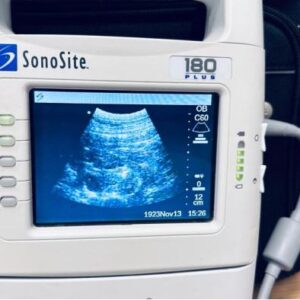 Refurbished SONOSITE 180 PLUS