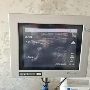 Used SONOSITE 180 PLUS