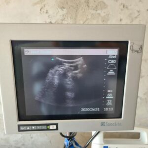 Used SONOSITE 180 PLUS