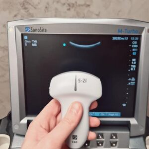 Refurbished SONOSITE M-Turbo