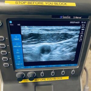 Used SONOSITE S-Nerve