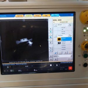 Used Very Good PHILIPS MOBILEDIAGNOST WDR